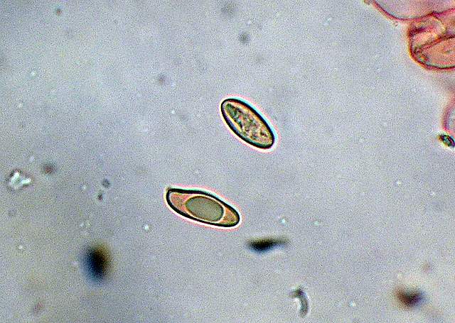 Xerocomus bubalinus   (Oolbekk. & Duin)  Redeuilh